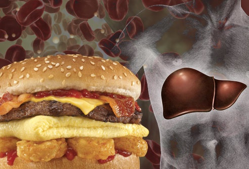 Cholesterol giúp bạn khỏe mạnh