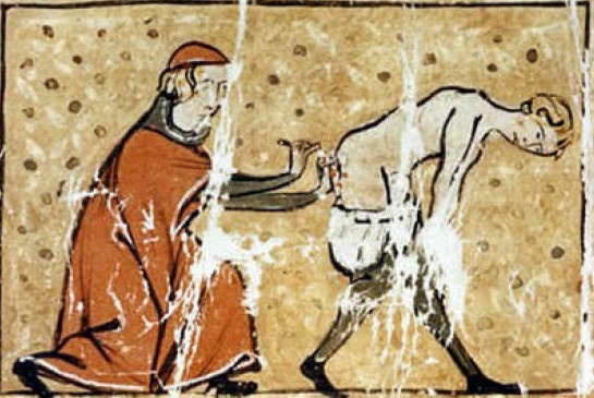 Những cách chữa bệnh đáng sợ thời Trung Cổ