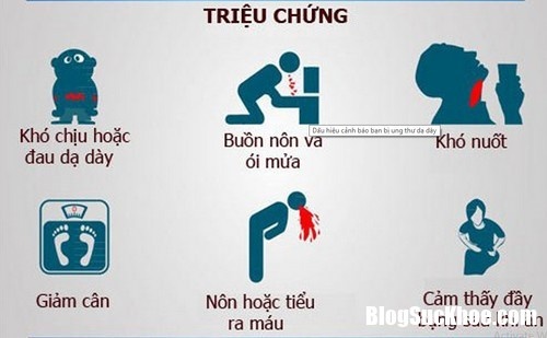 Ba căn bệnh ung thư phổ biến thường gặp ở đàn ông Việt Nam