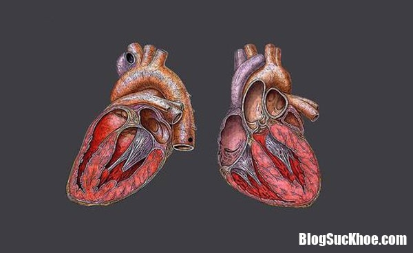 Nguyên nhân chính của bệnh cơ tim là do di truyền