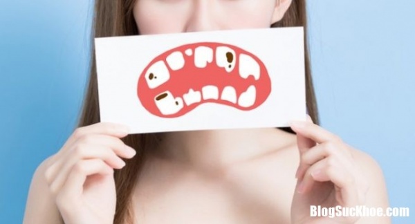 Tăng nguy cơ tử vong do sức khỏe răng miệng kém