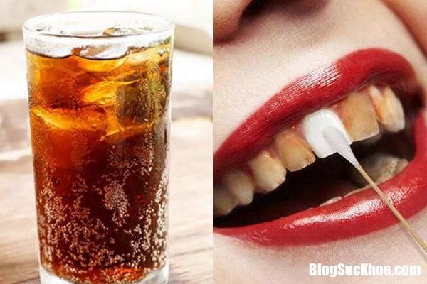 Những thói quen gây hại cho răng miệng cần tránh