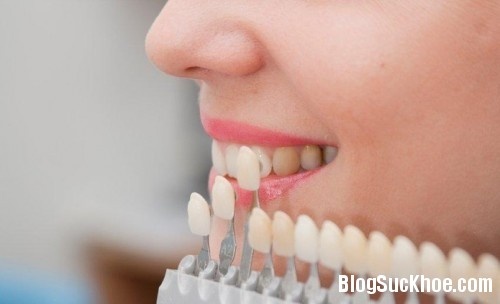 Mẹo giúp hạn chế khó chịu sau khi làm trắng răng