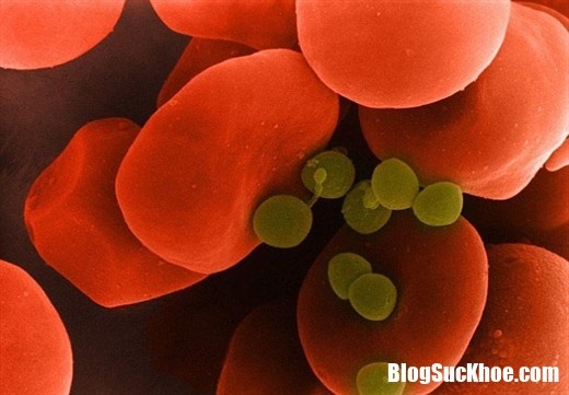 Những điều cần biết về căn bệnh nhiễm trùng máu
