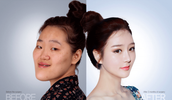 Hàn Quốc: Xấu xí là thất bại đời người đến hiện tượng "100 khuôn mặt trông như 1"
